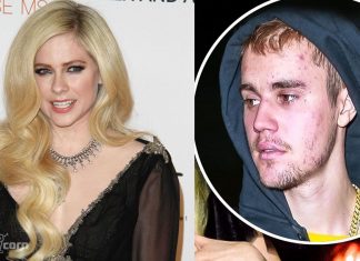 Avril Lavigne announces a special concert against Lyme disease Avril Lavigne against Lyme disease