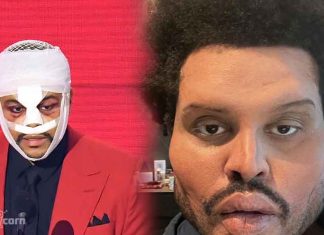 The Weeknd Shocked the fans with a new freaky face look The Weekndnew freaky face look